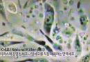 「清除動脈中積聚的脂肪」：心臟科醫師堅持遵循哪些生活方式指南？
